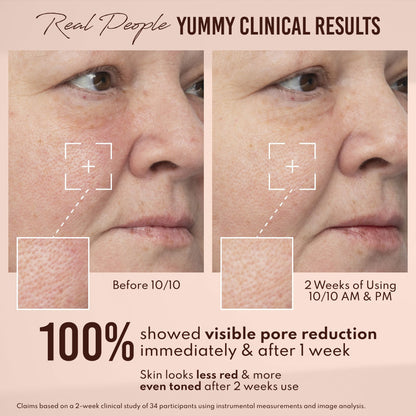 Yummy Skin 10/10 Barrier Boost Hyaluronic Acid + Ectoin Plumping Serum
